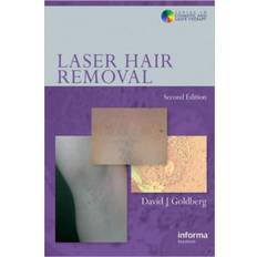 Laser Hair Removal - 9780415414128