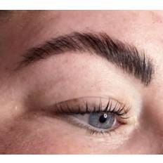 Brow Lift