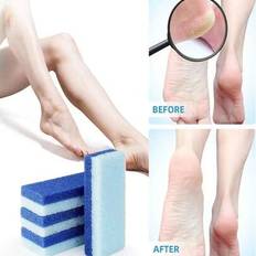 1/4 st Foot Pimpsten Exfolieringsfil, Callus Dead Skin Remover, Hälborste, Salon Foot Scrub Pad, Pedikyr Exfolieringsverktyg för män och kvinnor, Väsk - Blå (En-Storlek)
