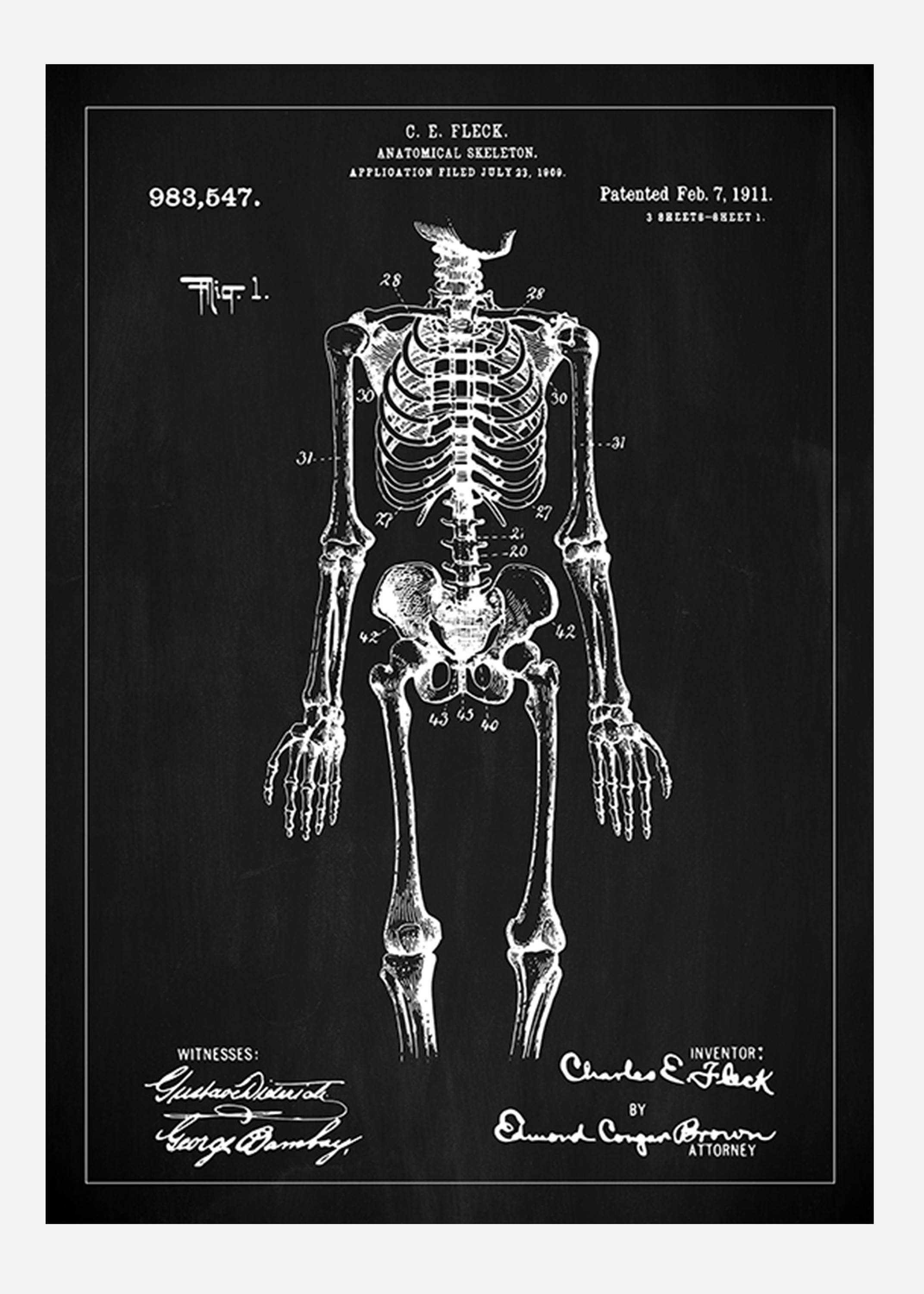 Patentritning - Anatomiskt Skelett I - Svart Canvastavla (50x70 cm)