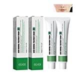 2 St. Whitening Fräknig Kräm, Spot-off Whitening För Fräknar Kräm, Ta Bort Melasma Cream, Acne Scar Removal Cream, Ta Bort Melasma Melanin Mörka Fläckar (2 Acne Cream)