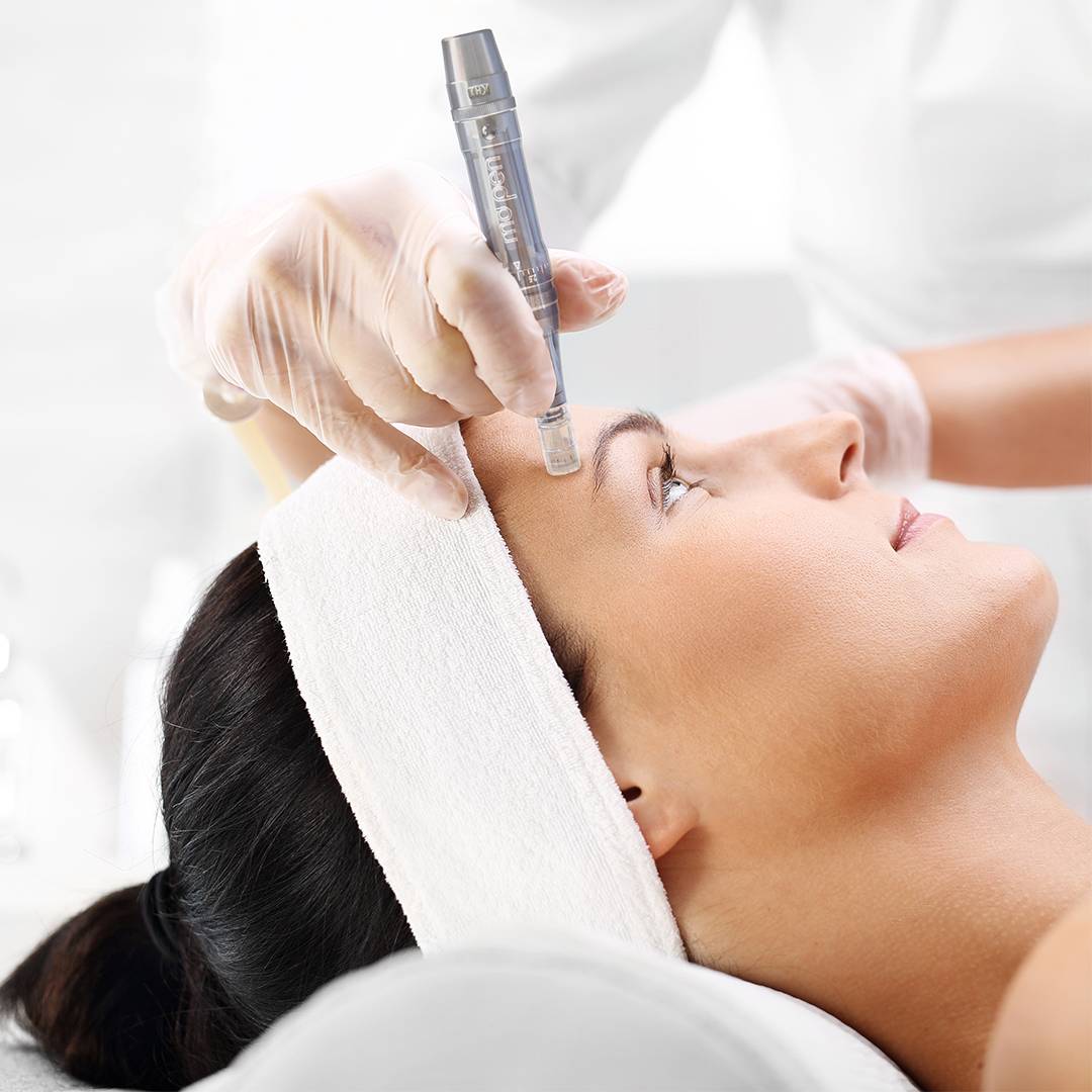 Ansigtsbehandling med Microneedling Kr.950.