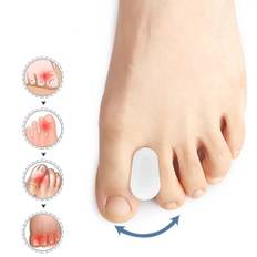 Tåspridare vid hallux valgus - 2 st - Separerar tårna för att minska smärta
