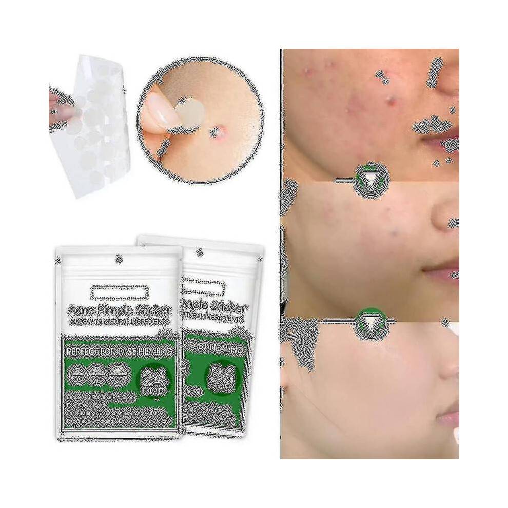 (2 x 24Pcs-3 Size) Acne Pimple Patch,invisible Hydrocolloid Acne Patch For Blemishes And Zits Cover, Spot Stickers For Face And Body