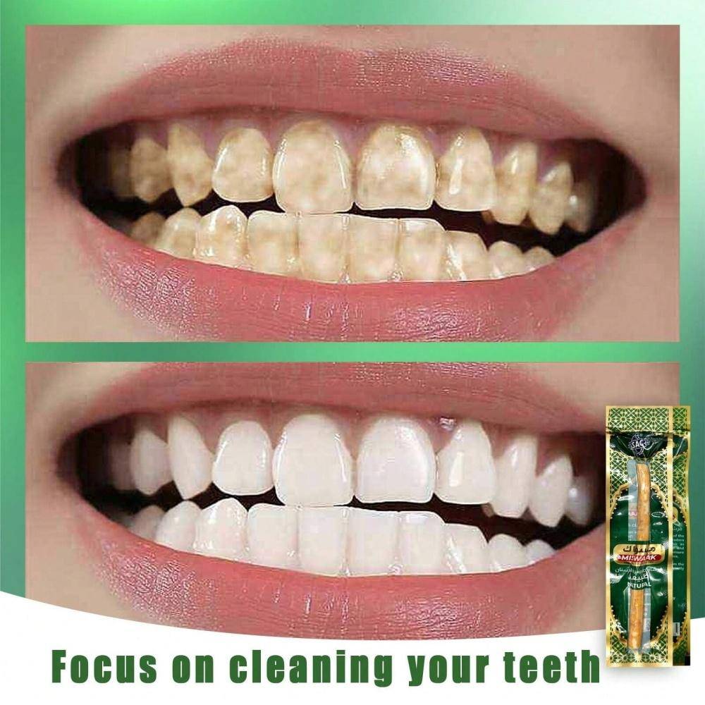 Naturlig Miswak Tandborste Vakuumförseglad Naturlig Smak Traditionell Tandborste Pinne För Friska Gums Tänder Fräschare Andedräkt Gåva