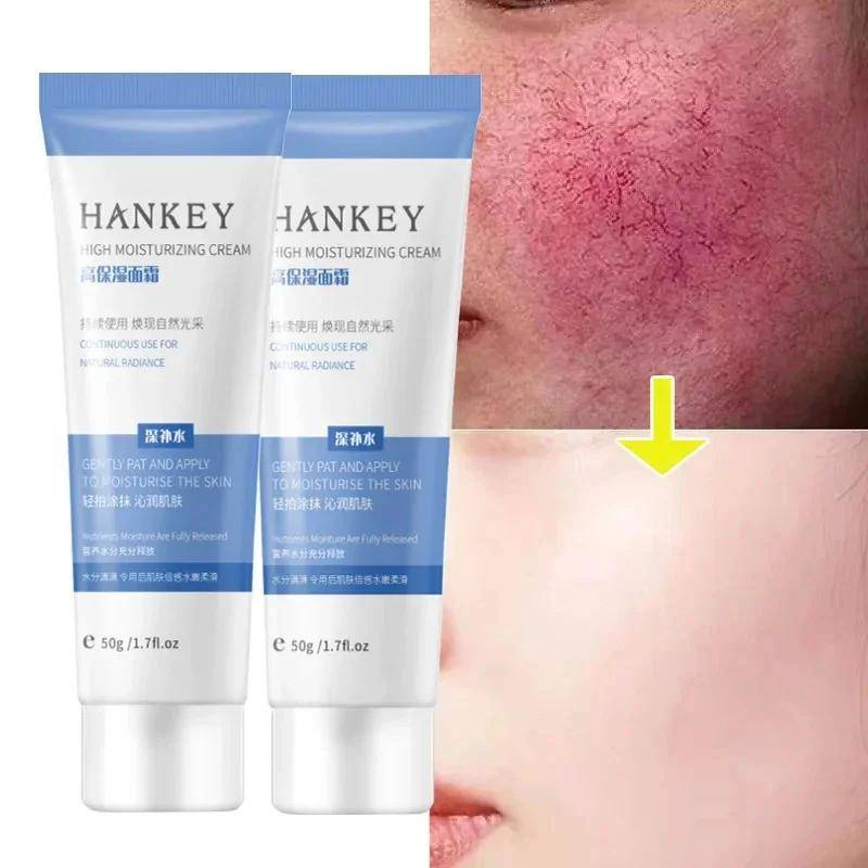 Ansiktsrodnad Reparerande Kräm Lugnande Känslig Hud Torrhet Fuktighetskräm Återfuktande Lotion Borttagning Rosacea Koreansk Hudvård mindre