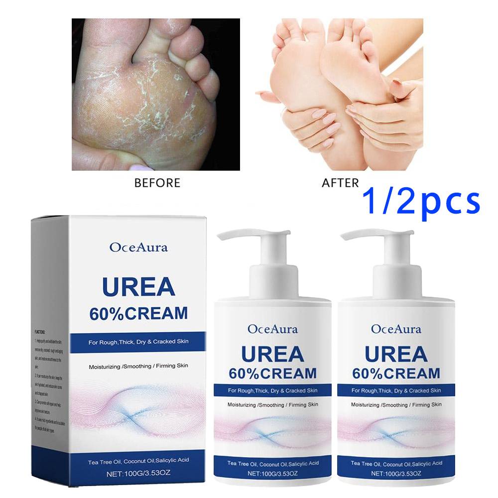 1/2pcs Urea 60% Cream Uric Acid Foot Cream for Heel Repair, Dry and Cracked Heel Treatment, Removes Dead Skin