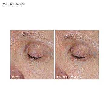 DermInfusions Lift + Repair Eye Mask 1 APP