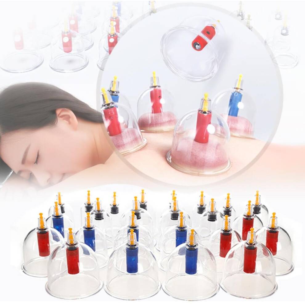 Professionelt cupping-sæt til anti-cellulite-udstyr, vakuummassage hjælper med behandling af influenza, forkølelse, bronkial astma, hypertension,