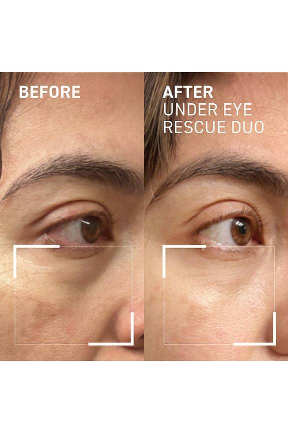 Eye Rescue Duo
