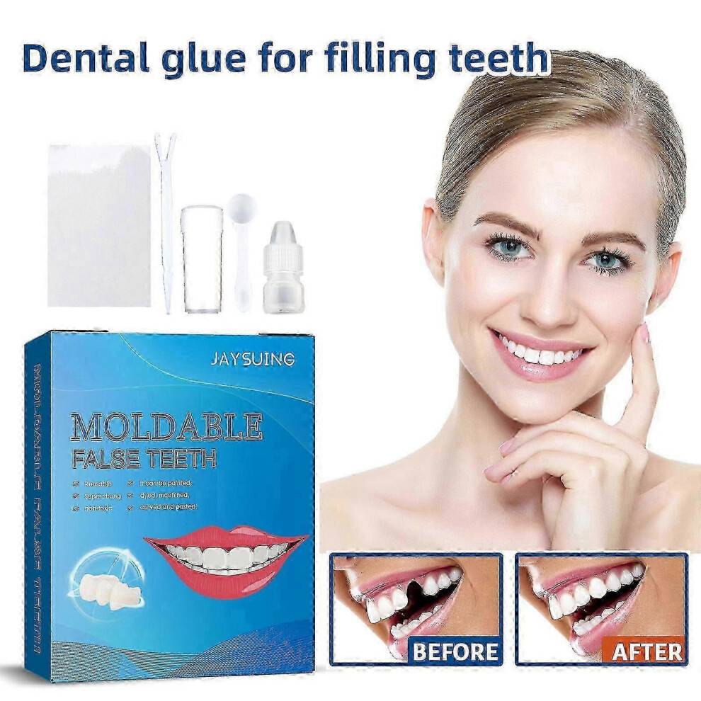 2025 Tooth Repair Kit, Dental Care Kit Glue for Filling Missing, Broken Teeth, Crowns And Bridges, Moldable Fake Teeth.
