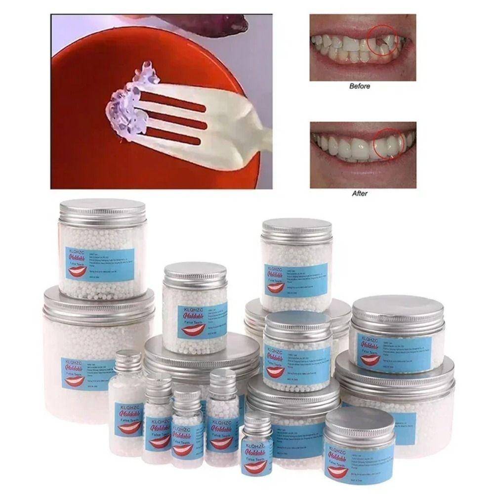 1 Styck Säkerhet Dental Tillbehör Tandreparationslim Tillfälligt falsktänder Lim Tandluckor Fyllning Solid