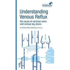 Varicose Understanding Venous Reflux the Cause of Varicose Veins and Venous Leg Ulcers (Häftad, 2011)