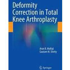 B total Deformity Correction in Total Knee Arthroplasty (Inbunden, 2014)