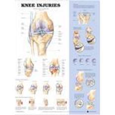 Bøger Knee Injuries Anatomical Chart (Indbundet, 2003)