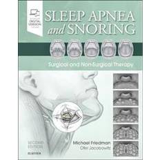 Snoring Sleep Apnea and Snoring (Hardcover, 2019)
