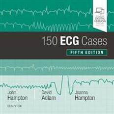 150 ECG Cases (Paperback, 2019)