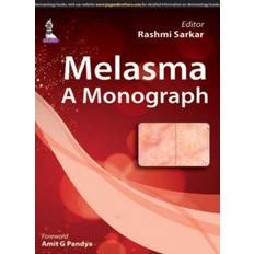 Melasma: A Monograph (Paperback, 2015)