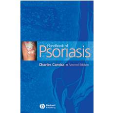 Handbook of Psoriasis (2005)