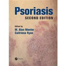 Psoriasis Psoriasis (Indbundet)