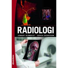 Radiologi digital produkt (E-bok)