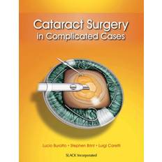 Cataract Surgery in Complicated Cases Lucio Buratto 9781617116070