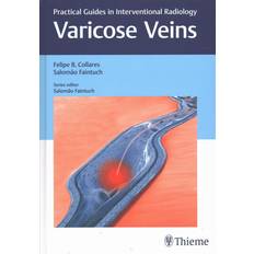 Varicose Veins Felipe Collares 9781626230125