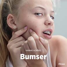 Bumser Hanne Korvig 9788728519134 (Lydbog, MP3)