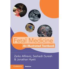 Fetal Medicine Zarko Alfirevic 9781009015943