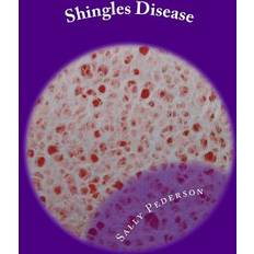 Shingles Disease Sally Pederson 9781478290629