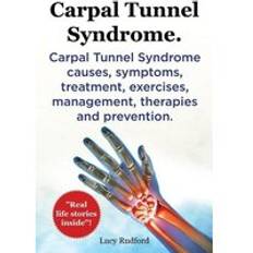 Carpal Tunnel Syndrome, Cts. Carpal Tunnel Syndrome Cts Causes, Symptoms, Treatment, Exercises, Management, Therapies and Prevention