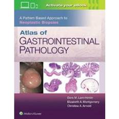 Bøker Atlas of Gastrointestinal Pathology: A Pattern Based Approach to Neoplastic Biopsies (Innbundet, 2018)