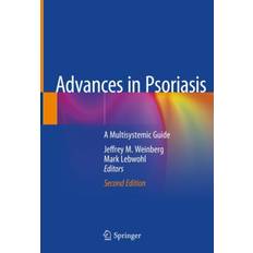 Advances in Psoriasis International Publishing (Gebunden)