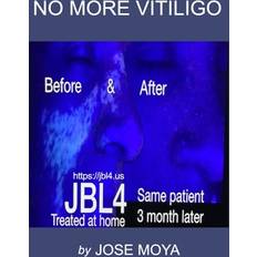 No More Vitiligo Jose Moya 9798876578679