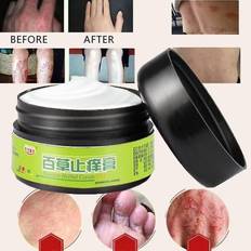 Medicines Effective Herbal Ointment Dermatitis Psoriasis Cream