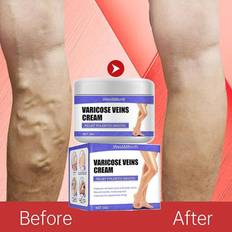 Varicose Relieve Tired Cream