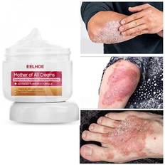 Medicines Antil Psoriasis Anti-itch Relief Dermatitis Urtic Desquamat Cream