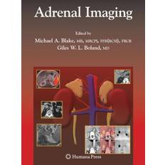 Adrenal Imaging