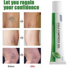 Varicose Vein Pain Relief Cream