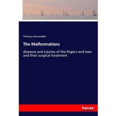 The Malformations Thomas Annandale 9783337482947 (Hæftet)