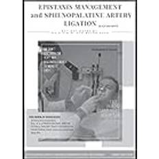 EPISTAXIS MANAGEMENT and SPHENOPALATINE ARTERY LIGATION Black and White: ENT HOT NOTEs by Dr. M.O.H.M. FOR BOARD EXAM Epistaxis SPA ligation book Ethmoidal artery ligation