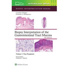 Biopsy Interpretation of the Gastrointestinal Tract Mucosa Volume 1 (Inbunden)