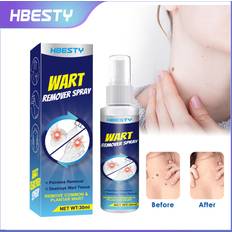 Wart Removal Spray Wart Pest Care Solution