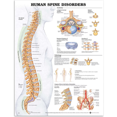 Human Spine Disorders Anatomical Chart