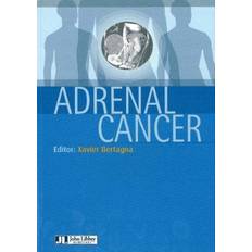 Adrenal Cancer