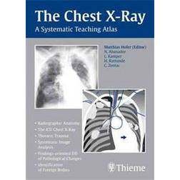 Chest X-ray Trainer: A Systematic Teaching Atlas (Paperback, 2006)