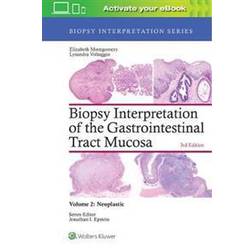 Biopsy Interpretation of the Gastrointestinal Tract Mucosa: Volume 2: Neoplastic (Inbunden, 2017)