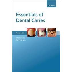 Essentials of Dental Caries (Paperback, 2016)