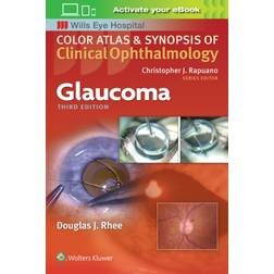 Glaucoma (Color Atlas & Synopsis of Clinical Ophthalmology)