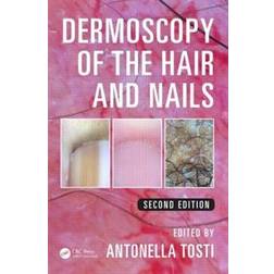 Dermoscopy of the Hair and Nails (Inbunden, 2015)